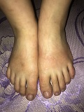 Foot Fetish Photo